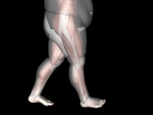 Flatter Arches May Be Indicative of Excess Weight Gain